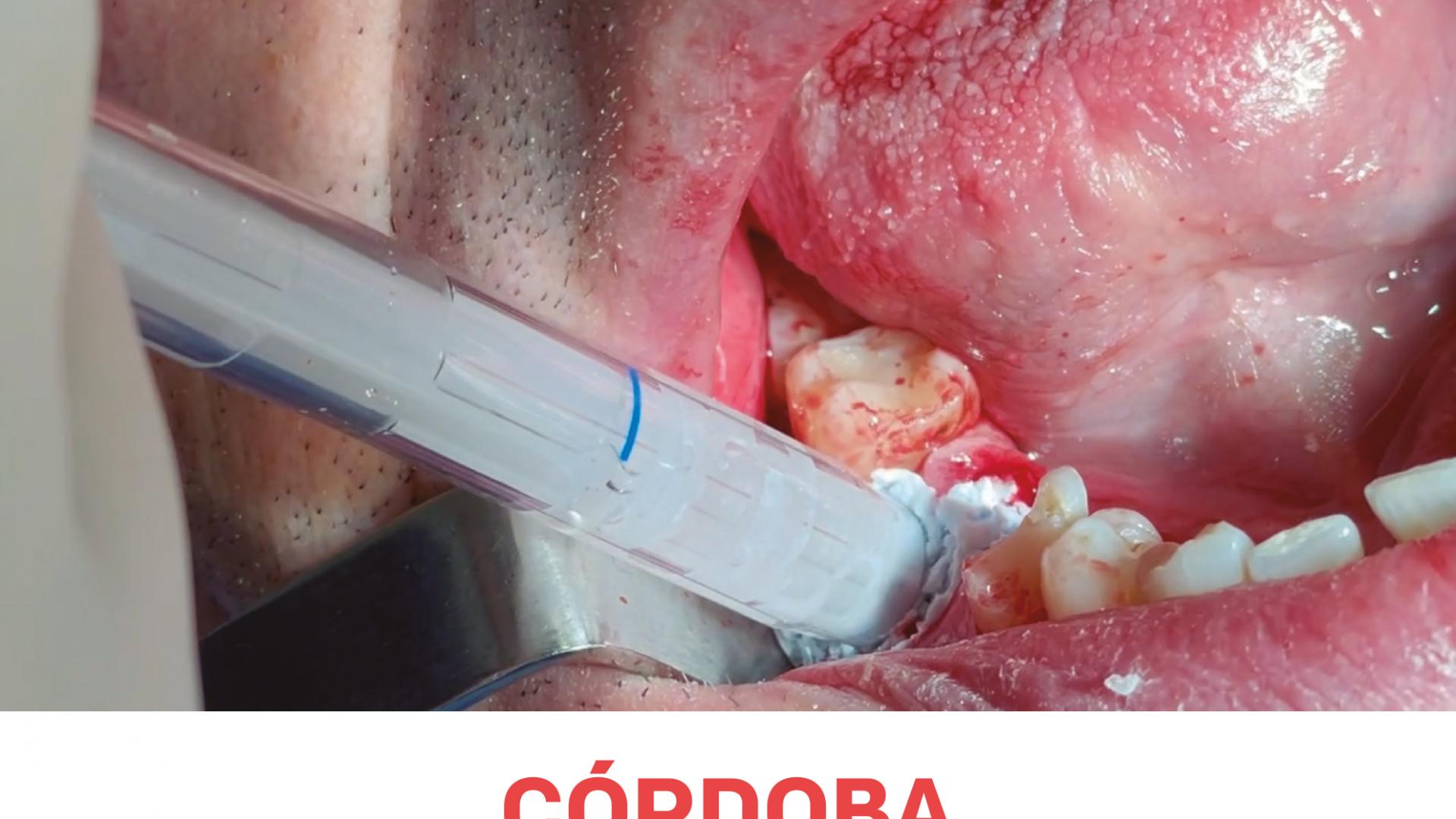 ABCORDOBA